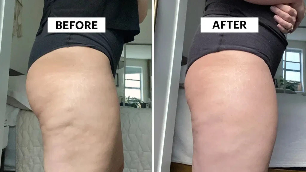 Do Toning Exercise Pinner Really Tackle Cellulite?